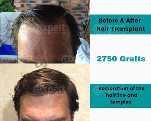 Cosmetic Expert Hair Transplant , Skin and Plastic Surgery Clinic,  Peshawar, Pakistan - business info, customer/client reviews, phone, email,  website