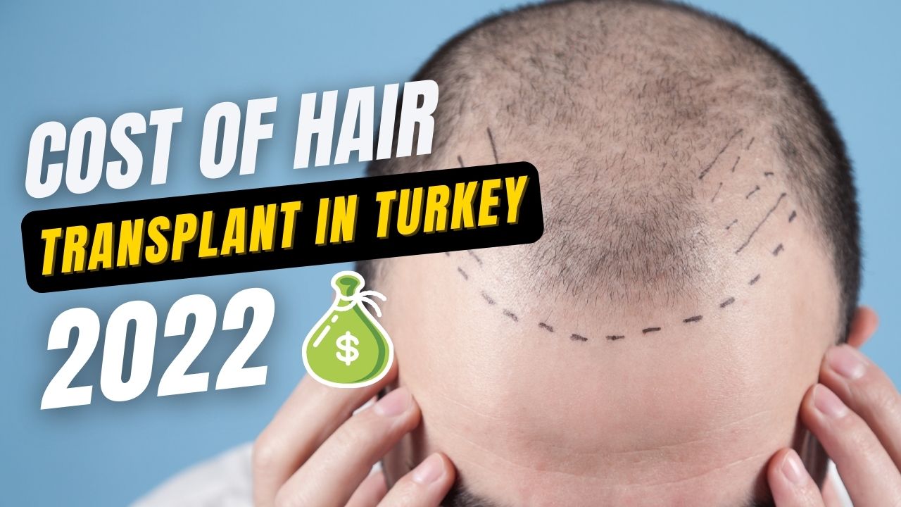 Cost of Hair Transplant in Turkey : What changes in 2022? 